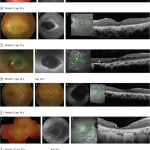 Fundus Bilder Übersicht